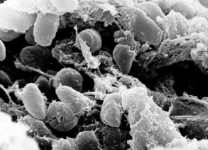 Micrographie de la bacterie Yersinia pestis, agent de la peste